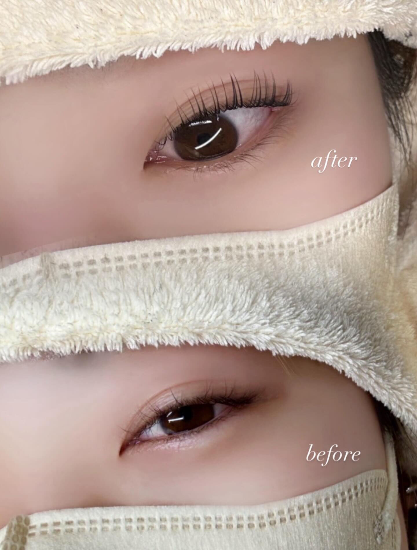before → after✨